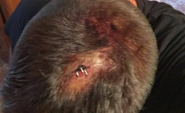 El agredido muestra la herida que sufrió en la cabeza.