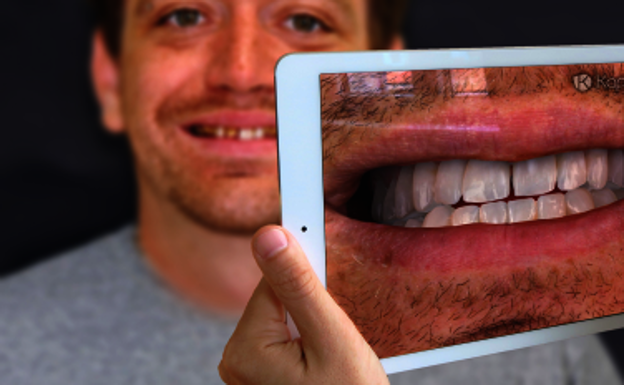 El software acelera el proceso de cambio dental./Kapanu