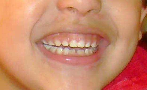 Esta es la edad a la que los niños deben empezar a ir al dentista