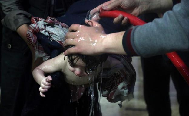 Un niño es tratado en un hospital de Duma (Siria)./Reuters